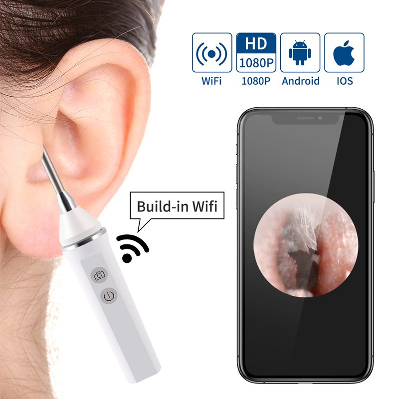 Nettoyeu oreille intelligent, Endoscope WIFI