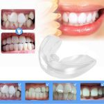 3 étapes dentaires orthodontiques appareil accolades alignement formateur dents retenue bruxisme garde-bouche dents lisseur